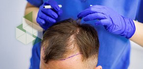 Клиника HFE безоперационная пересадка волос  