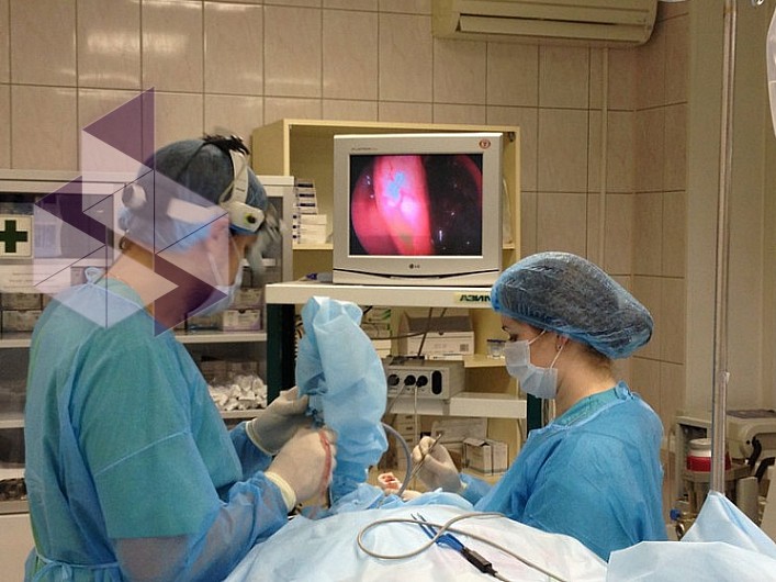 Вазотомия носовых раковин операция. ЛОР операция вазотомия. Вазотомия после операции.