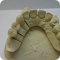 Зуботехническая лаборатория Корона-керамик